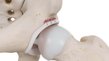 クイックボール ur3枚 AQDEXOH5D6.8 アクアドリルEX オイルホール5D NACHI(不二越) 超
